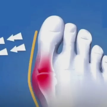 2x1 Corrector Mágico de Juanetes